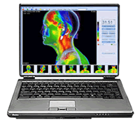 infrared screening software overlay